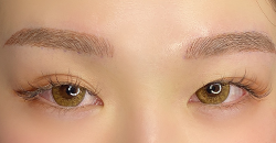 brow