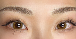 brow