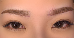 brow