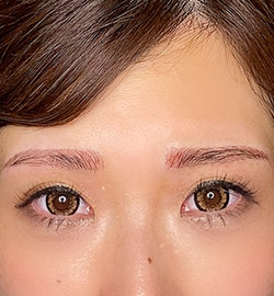 brow